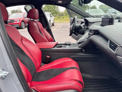 2024 Acura TLX Type S