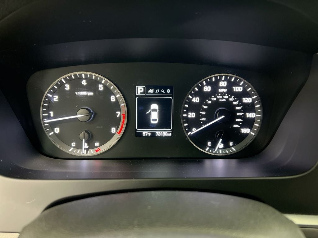 2017 Hyundai Sonata Sport